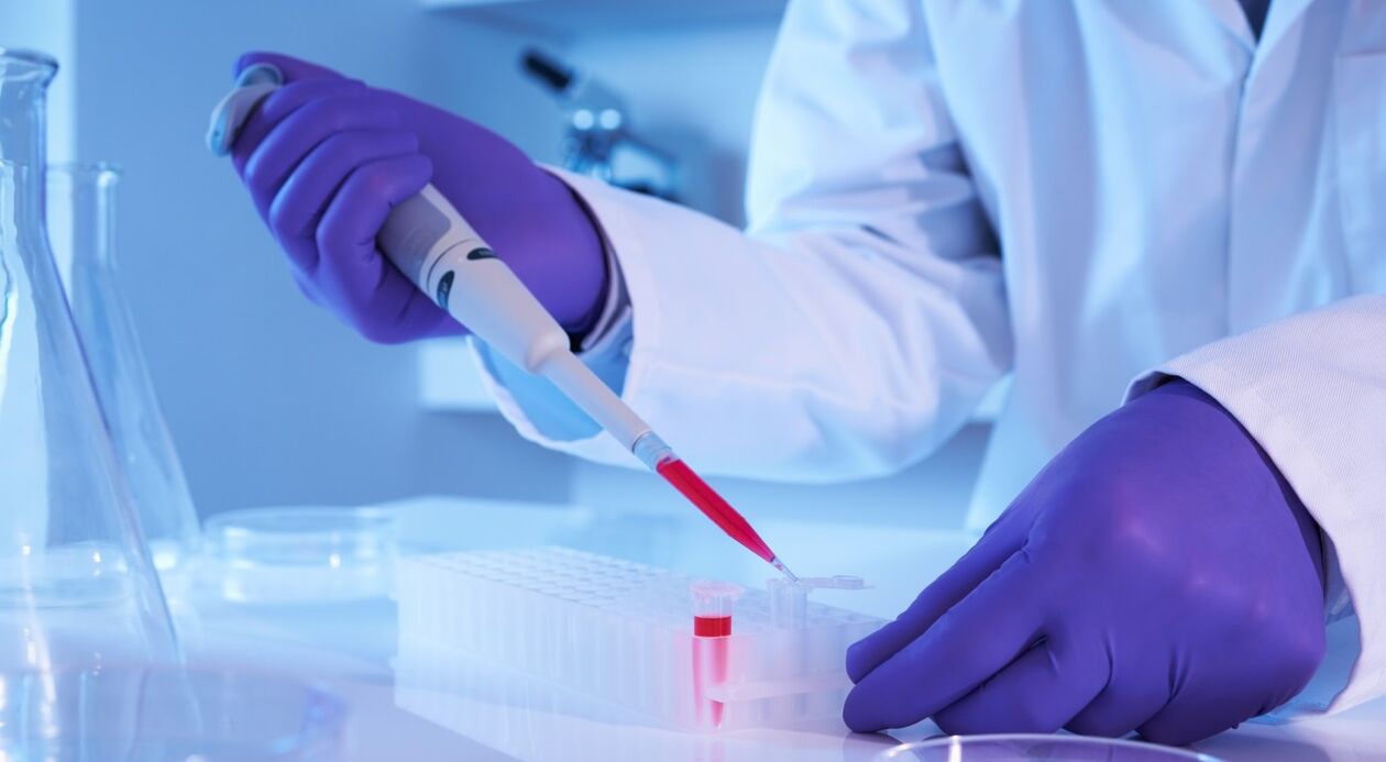 How to get a parasite analysis