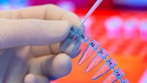 How to be tested for parasites