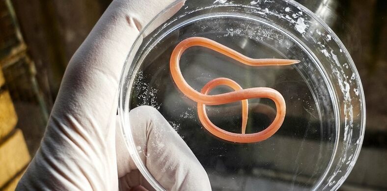 parasite from the human body