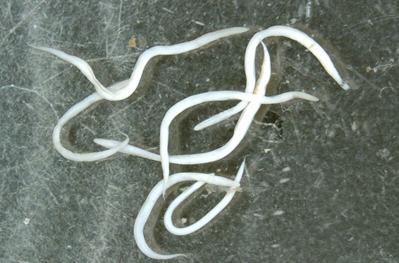 parasitic worms from the human body