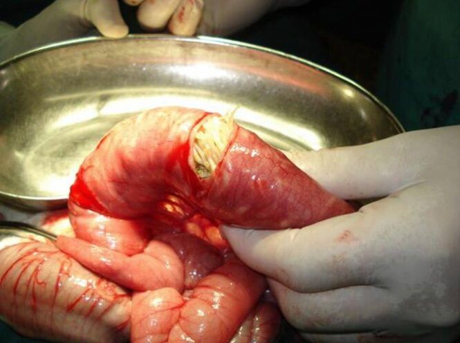 Ches parasites are dangerous to humans